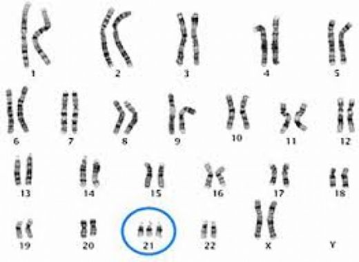 Kromozom Zerinde Bulunan Genler