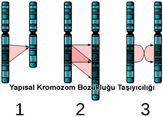 7 Kromozom Bozukluu