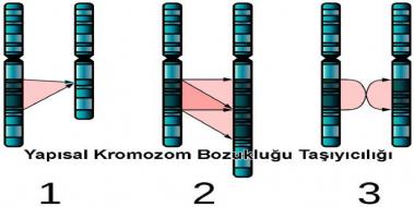 9 Kromozom Bozukluu